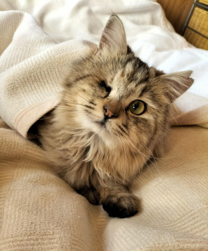 片目でも捨てられても…私はアイドル♡